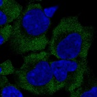 Anti-GIGYF2 Antibody