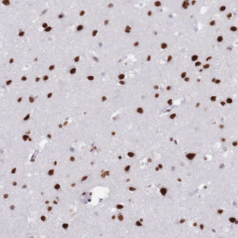 Anti-SAFB2 Antibody