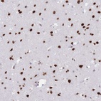 Anti-SAFB2 Antibody