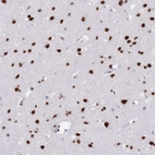 Anti-SAFB2 Antibody