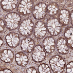 Immunohistochemical staining of human colon shows strong cytoplasmic positivity in glandular cells.