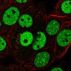 Immunofluorescent staining of human cell line MCF7 shows localization to nucleoplasm, nuclear bodies & vesicles.