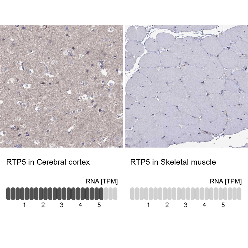 Anti-RTP5 Antibody