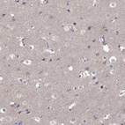 Immunohistochemical staining of human cerebral cortex shows weak positivity in neuropil.