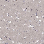 Immunohistochemical staining of human cerebral cortex shows weak positivity in neuropil.