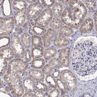 Anti-RTP5 Antibody