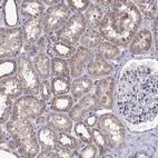 Immunohistochemical staining of human kidney shows moderate cytoplasmic positivity in cells in tubules.
