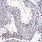 Immunohistochemical staining of human testis shows no positivity in cells in seminiferous ducts as expected.