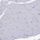 Immunohistochemical staining of human skeletal muscle shows no positivity in myocytes as expected.