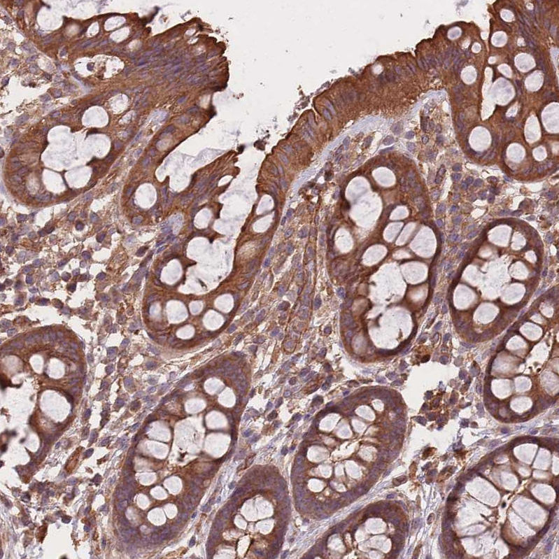 Anti-C10orf76 Antibody