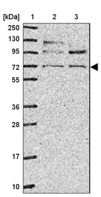 Lane 1: Marker [kDa] 250, 130, 95, 72, 55, 36, 28, 17, 10_br/_Lane 2: Human cell line RT-4_br/_Lane 3: Human cell line U-251MG sp