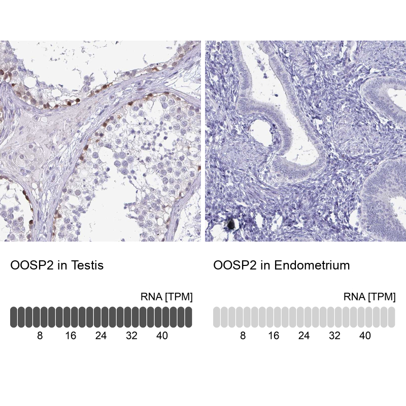 Anti-OOSP2 Antibody