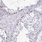 Immunohistochemical staining of human testis shows high expression.