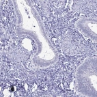 Immunohistochemical staining of human endometrium shows low expression as expected.