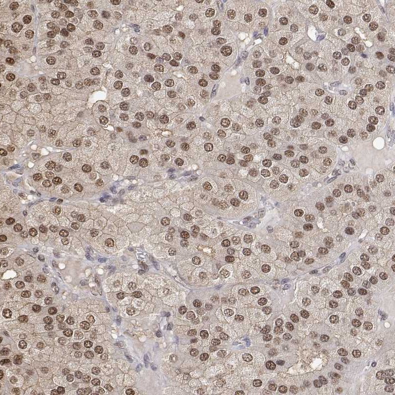 Anti-TPI1 Antibody