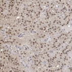 Anti-TPI1 Antibody