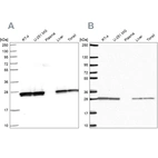 Western blot analysis using Anti-TPI1 antibody HPA050924 (A) shows similar pattern to independent antibody HPA053568 (B).