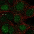 Immunofluorescent staining of human cell line MCF7 shows localization to nucleus & vesicles.