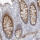 Immunohistochemical staining of human colon shows strong cytoplasmic positivity in glandular cells.