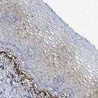 Immunohistochemical staining of human cervix shows moderate cytoplasmic and membranous positivity in squamous epithelial cells.