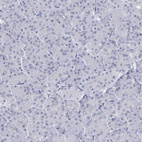 Anti-C10orf99 Antibody