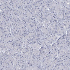 Immunohistochemical staining of human pancreas shows no positivity in exocrine glandular cells as expected.