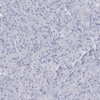 Immunohistochemical staining of human pancreas shows no positivity in exocrine glandular cells as expected.