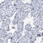 Immunohistochemical staining of human placenta shows no positivity in trophoblastic cells as expected.