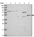Lane 1: Marker [kDa] 250, 130, 95, 72, 55, 36, 28, 17, 10_br/_Lane 2: Human cell line RT-4_br/_Lane 3: Human cell line U-251MG sp_br/_Lane 4: Human plasma (IgG/HSA depleted)_br/_Lane 5: Human liver tissue_br/_Lane 6: Human tonsil tissue