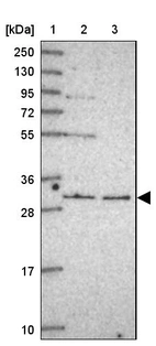 Lane 1: Marker [kDa] 250, 130, 95, 72, 55, 36, 28, 17, 10_br/_Lane 2: Human cell line RT-4_br/_Lane 3: Human cell line U-251MG sp