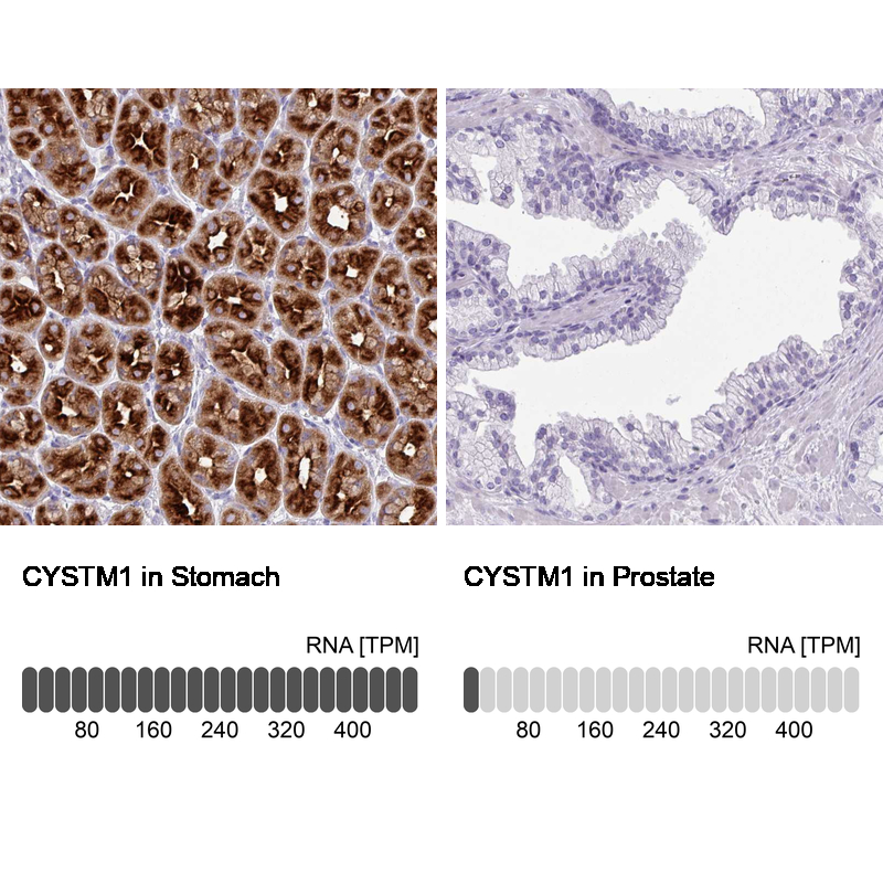 Anti-CYSTM1 Antibody