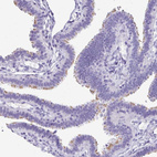 Immunohistochemical staining of human fallopian tube moderate positivity in cilia in glandular cells.