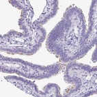 Immunohistochemical staining of human fallopian tube moderate positivity in cilia in glandular cells.