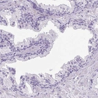 Immunohistochemical staining of human prostate shows no positivity in glandular cells as expected.