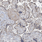 Immunohistochemical staining of human placenta shows weak cytoplasmic positivity in trophoblastic cells.