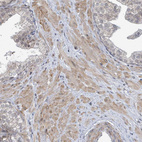 Immunohistochemical staining of human prostate shows weak cytoplasmic positivity in smooth muscle cells.