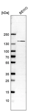 Western blot analysis in human cell line BEWO.