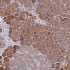 Anti-PPP6C Antibody