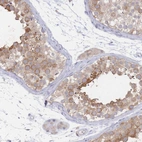 Immunohistochemical staining of human testis shows weak to moderate cytoplasmic positivity in cells in seminiferous ducts.
