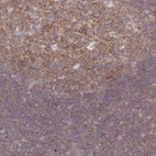 Immunohistochemical staining of human tonsil shows moderate cytoplasmic positivity in germinal center cells.