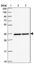 Lane 1: Marker [kDa] 250, 130, 95, 72, 55, 36, 28, 17, 10_br/_Lane 2: Human cell line RT-4_br/_Lane 3: Human cell line U-251MG sp