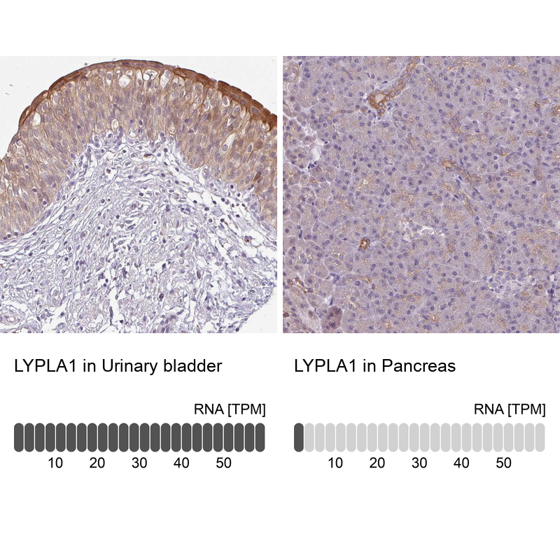 Anti-LYPLA1 Antibody