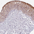 Immunohistochemical staining of human urinary bladder shows high expression.