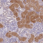 Anti-OR5T1 Antibody