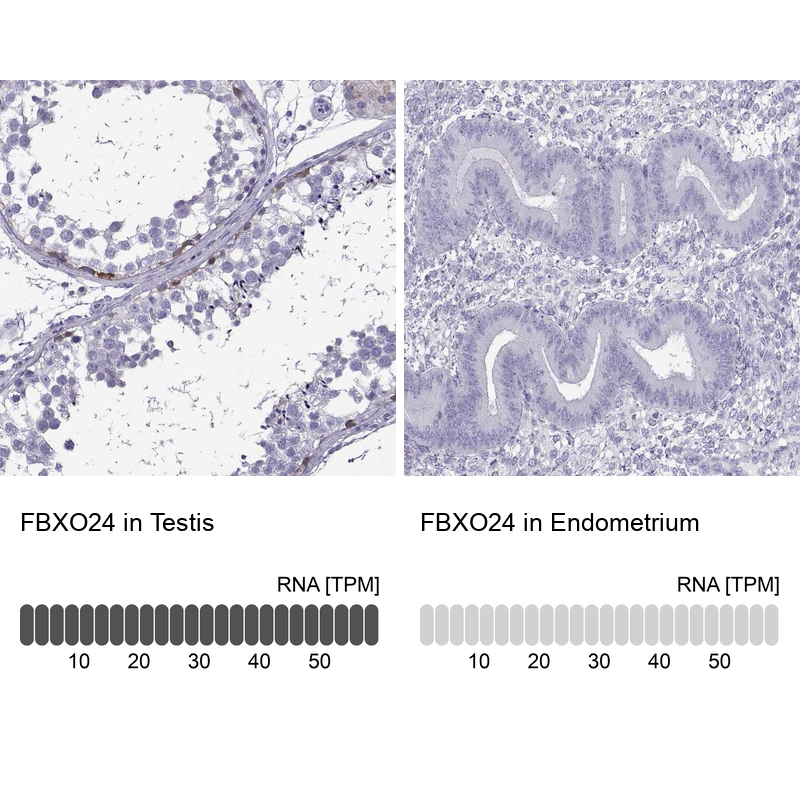 Anti-FBXO24 Antibody