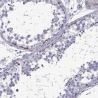 Immunohistochemical staining of human testis shows high expression.