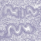 Immunohistochemical staining of human endometrium shows low expression as expected.