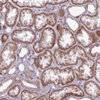 Anti-AVL9 Antibody