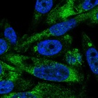 Immunofluorescent staining of human cell line PC-3 shows localization to endoplasmic reticulum.