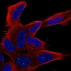 Anti-UNC80 Antibody